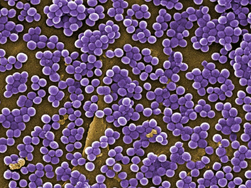Een microscopische uitvergroting van de MRSA-bacterie